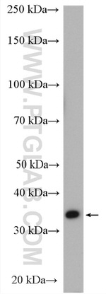 HSDL1 Antibody in Western Blot (WB)