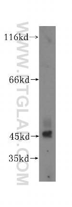 TEX28 Antibody in Western Blot (WB)