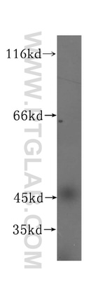 TEX28 Antibody in Western Blot (WB)