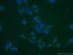 MGAT5B Antibody in Immunocytochemistry (ICC/IF)