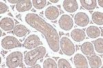 SCAPER Antibody in Immunohistochemistry (Paraffin) (IHC (P))