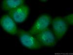 TBC1D23 Antibody in Immunocytochemistry (ICC/IF)