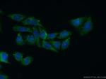 HPD Antibody in Immunocytochemistry (ICC/IF)