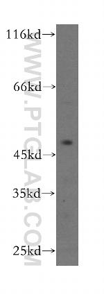 CENPL Antibody in Western Blot (WB)