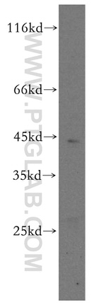 CENPL Antibody in Western Blot (WB)