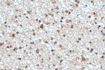 RECQL4 Antibody in Immunohistochemistry (Paraffin) (IHC (P))