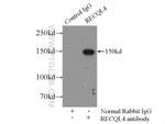 RECQL4 Antibody in Immunoprecipitation (IP)