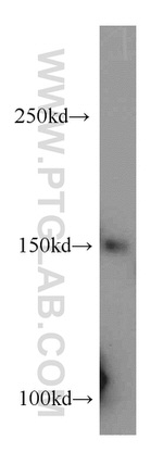 RECQL4 Antibody in Western Blot (WB)