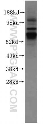 FAM65B Antibody in Western Blot (WB)