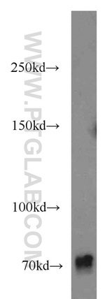 FAM65B Antibody in Western Blot (WB)