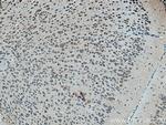 ELP3 Antibody in Immunohistochemistry (Paraffin) (IHC (P))