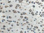 ELP3 Antibody in Immunohistochemistry (Paraffin) (IHC (P))