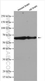 ELP3 Antibody in Western Blot (WB)