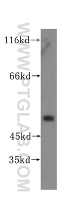 PPM1F Antibody in Western Blot (WB)