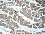 APCDD1 Antibody in Immunohistochemistry (Paraffin) (IHC (P))
