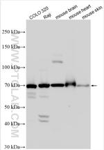 APCDD1 Antibody in Western Blot (WB)