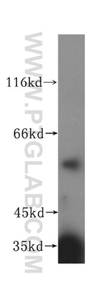 NOC4L Antibody in Western Blot (WB)