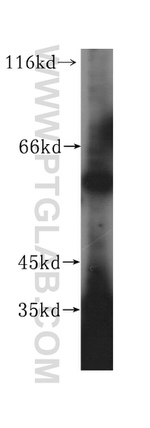 NOC4L Antibody in Western Blot (WB)
