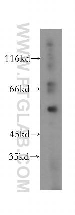 NOC4L Antibody in Western Blot (WB)