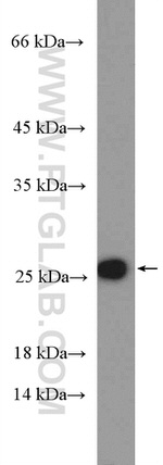 RPL18 Antibody in Western Blot (WB)