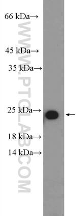 RPL18 Antibody in Western Blot (WB)