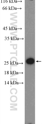 RPL18 Antibody in Western Blot (WB)