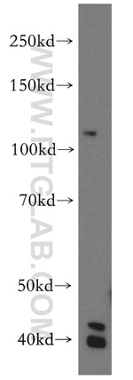H2AFY2 Antibody in Western Blot (WB)
