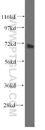 GRK5 Antibody in Western Blot (WB)