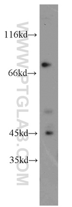 GRK5 Antibody in Western Blot (WB)