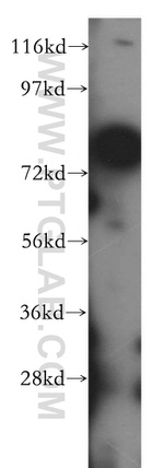 MUT Antibody in Western Blot (WB)