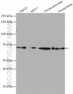 METAP2 Antibody in Western Blot (WB)
