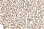 AGXT2L1 Antibody in Immunohistochemistry (Paraffin) (IHC (P))