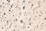 AGXT2L1 Antibody in Immunohistochemistry (Paraffin) (IHC (P))