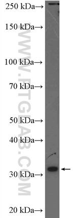 DNAJC27 Antibody in Western Blot (WB)