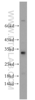DNAJC27 Antibody in Western Blot (WB)