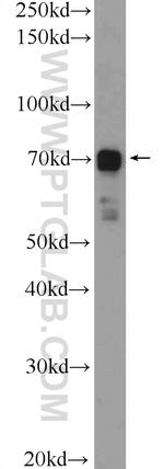 CLIP4 Antibody in Western Blot (WB)