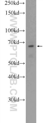 CLIP4 Antibody in Western Blot (WB)