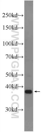 DPPA4 Antibody in Western Blot (WB)