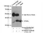 STARD10 Antibody in Immunoprecipitation (IP)