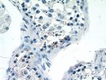 LATS1 Antibody in Immunohistochemistry (Paraffin) (IHC (P))