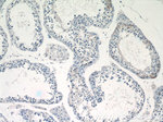 LATS1 Antibody in Immunohistochemistry (Paraffin) (IHC (P))
