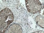 LATS1 Antibody in Immunohistochemistry (Paraffin) (IHC (P))