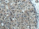LATS1 Antibody in Immunohistochemistry (Paraffin) (IHC (P))