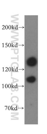 LATS1 Antibody in Western Blot (WB)