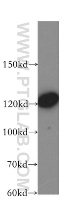 LATS1 Antibody in Western Blot (WB)