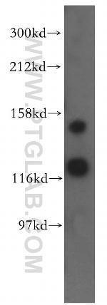 LATS1 Antibody in Western Blot (WB)