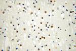 INTS7 Antibody in Immunohistochemistry (Paraffin) (IHC (P))