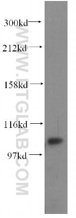 INTS7 Antibody in Western Blot (WB)