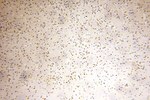 INTS7 Antibody in Immunohistochemistry (Paraffin) (IHC (P))