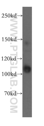 INTS7 Antibody in Western Blot (WB)